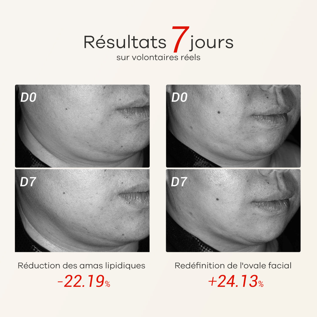 Perles de Beauté Liftantes Double Menton Blé de Fonty