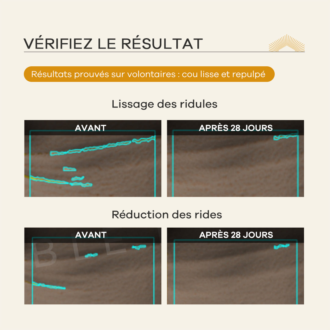 Perles 3D Fermeté & Réparation Contour Cou — 30 perles